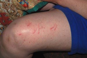 Cats and earthquakes